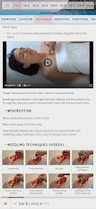 Acupuncture Atlas 3D app screenshot 2